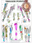 TRIGGER POINTS PART 2 ANATOMICAL DIAGRAM CHART ANATOMY PRINT PREMIUM POSTER TRIGGER POINTS PART 2 ANATOMICAL DIAGRAM CHART ANATOMY PRINT PREMIUM POSTER
