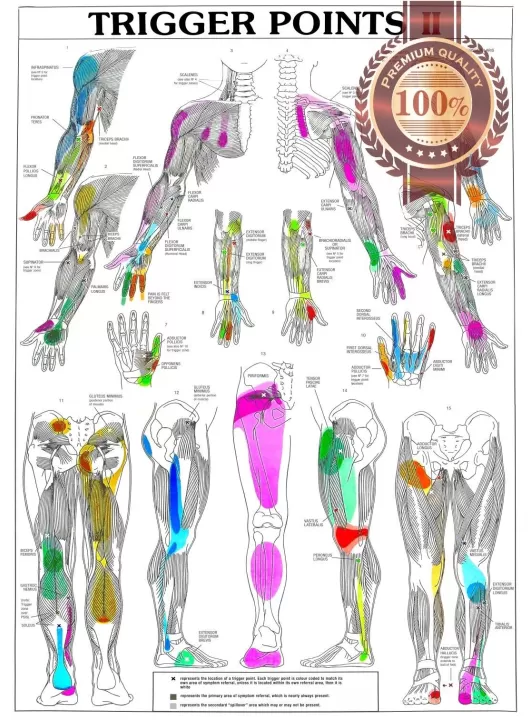 TRIGGER POINTS PART 2 ANATOMICAL DIAGRAM CHART ANATOMY PRINT PREMIUM POSTER TRIGGER POINTS PART 2 ANATOMICAL DIAGRAM CHART ANATOMY PRINT PREMIUM POSTER