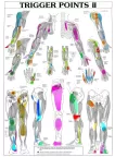 TRIGGER POINTS PART 2 ANATOMICAL DIAGRAM CHART ANATOMY PRINT PREMIUM POSTER TRIGGER POINTS PART 2 ANATOMICAL DIAGRAM CHART ANATOMY PRINT PREMIUM POSTER