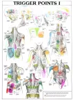 TRIGGER POINTS PART 1 ANATOMICAL DIAGRAM CHART ANATOMY PRINT PREMIUM POSTER TRIGGER POINTS PART 1 ANATOMICAL DIAGRAM CHART ANATOMY PRINT PREMIUM POSTER