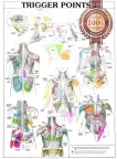 TRIGGER POINTS PART 1 ANATOMICAL DIAGRAM CHART ANATOMY PRINT PREMIUM POSTER TRIGGER POINTS PART 1 ANATOMICAL DIAGRAM CHART ANATOMY PRINT PREMIUM POSTER