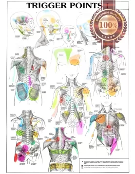 TRIGGER POINTS PART 1 ANATOMICAL DIAGRAM CHART ANATOMY PRINT PREMIUM POSTER