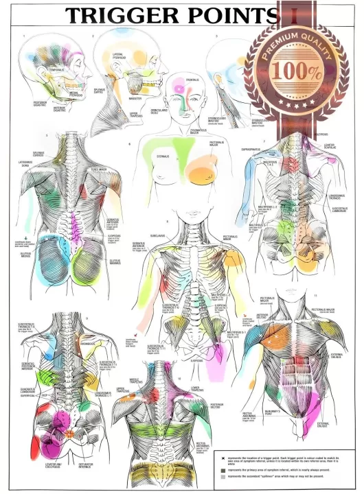TRIGGER POINTS PART 1 ANATOMICAL DIAGRAM CHART ANATOMY PRINT PREMIUM POSTER TRIGGER POINTS PART 1 ANATOMICAL DIAGRAM CHART ANATOMY PRINT PREMIUM POSTER